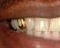Dental scrap gold